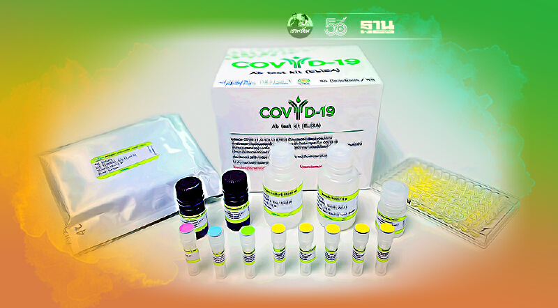 ไบโอเทค พัฒนาชุดตรวจหาปริมาณภูมิคุ้มกันโควิด เร็ว แม่นยำ ลดนำเข้า