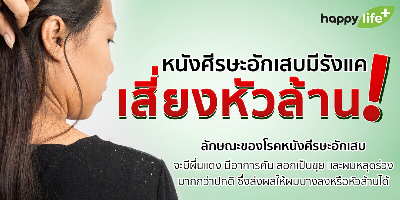 หนังศีรษะอักเสบเป็นรังแค เสี่ยงหัวล้าน