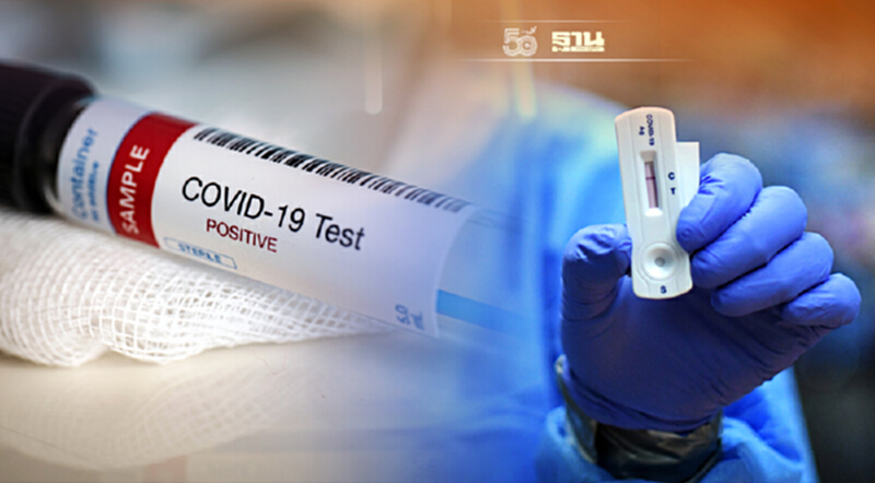 ติดเชื้อโควิด-19 รายวันยังเกินหมื่น หมอธีระชี้ต้องดูทั้ง RT-PCR รวม ATK ติดเชื้อโควิด-19 รายวันยังเกินหมื่น หมอธีระชี้ต้องดูทั้ง RT-PCR รวม ATK