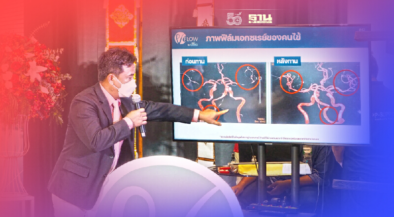 มช.วิจัย 3 สมุนไพร ขิง-พุทราจีน-เห็ดหูหนูดำ ดูแลคนเส้นเลือดตีบ