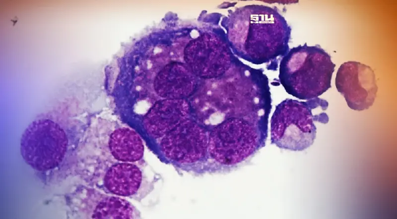 ม.มหิดล พบกระบวนการกระตุ้นสร้างเกล็ดเลือด ลดวิกฤติขาดแคลนผู้บริจาค