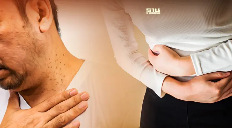 เช็คลิสต์ 7 สัญญาณเตือน “มะเร็ง” มหัตภัยร้าย