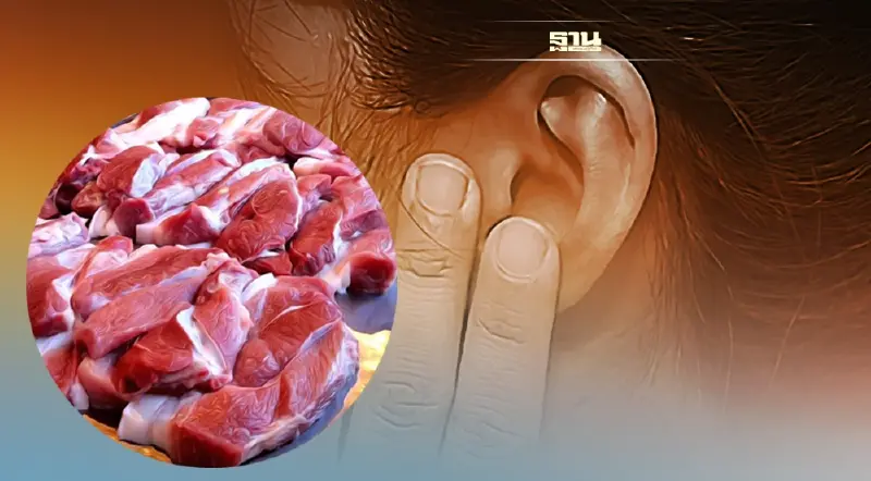 สธ.เตือน กินหมูดิบ สุกๆดิบๆ เสี่ยงเป็นโรคไข้หูดับ