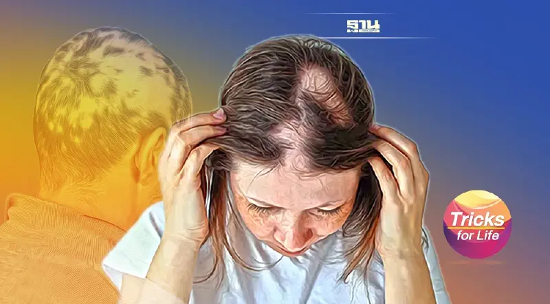 รู้จัก “โรคผมร่วงเป็นหย่อม” ตบช็อกโลก “วิลล์ สมิธ”  เป็นได้ ก็หายได้