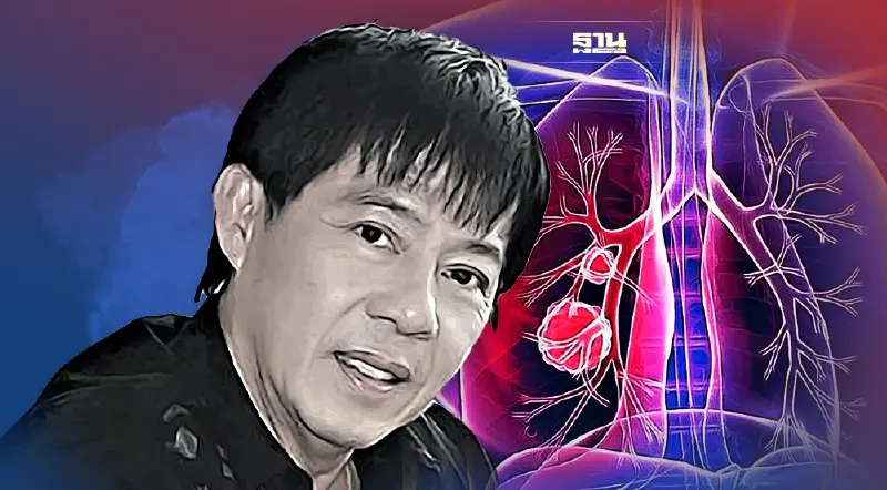สัญญาณเตือน“มะเร็งปอด” คร่าชีวิต“วิทยา ศุภพรโอภาส”มีอาการเหล่านี้ระวัง