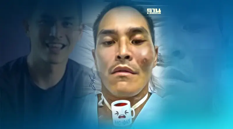 "สงกรานต์ เตชะณรงค์" ป่วยเป็นอะไรต้องนอนไอซียู  เช็คที่นี่