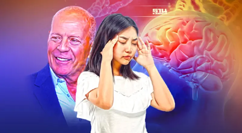 ป่วยโรค “อะเฟเซีย” เหมือน “บรูซ วิลลิส” ควรพบแพทย์ ป่วยโรค “อะเฟเซีย” เหมือน “บรูซ วิลลิส” ควรพบแพทย์
