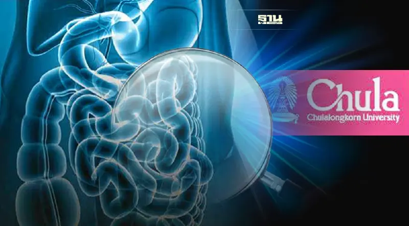 จุฬาฯ พัฒนา DeepGI AI ตรวจมะเร็งลำไส้ใหญ่แบบแม่นยำ