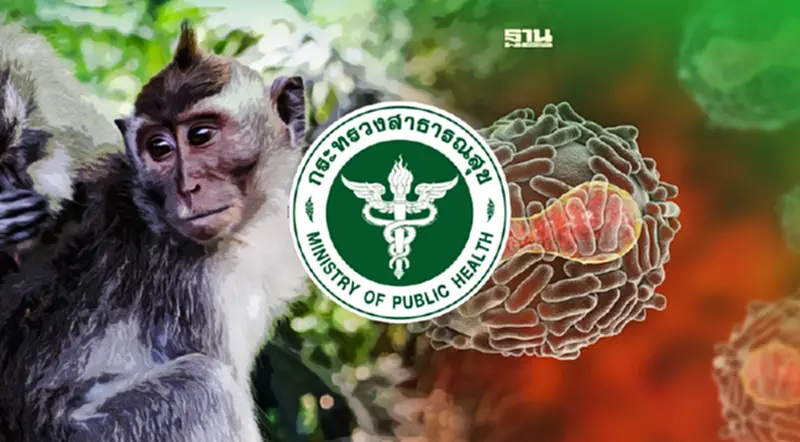 สาธารณสุข กำหนด "ฝีดาษลิง" เป็นโรคติดต่อเฝ้าระวัง ยังไม่พบรายงานในไทย สาธารณสุข กำหนด "ฝีดาษลิง" เป็นโรคติดต่อเฝ้าระวัง ยังไม่พบรายงานในไทย