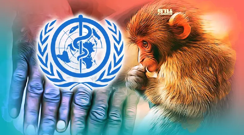 WHO มั่นใจคุม"ฝีดาษลิง"ได้ ไม่จำเป็นต้องฉีดวัคซีนให้คนหมู่มาก