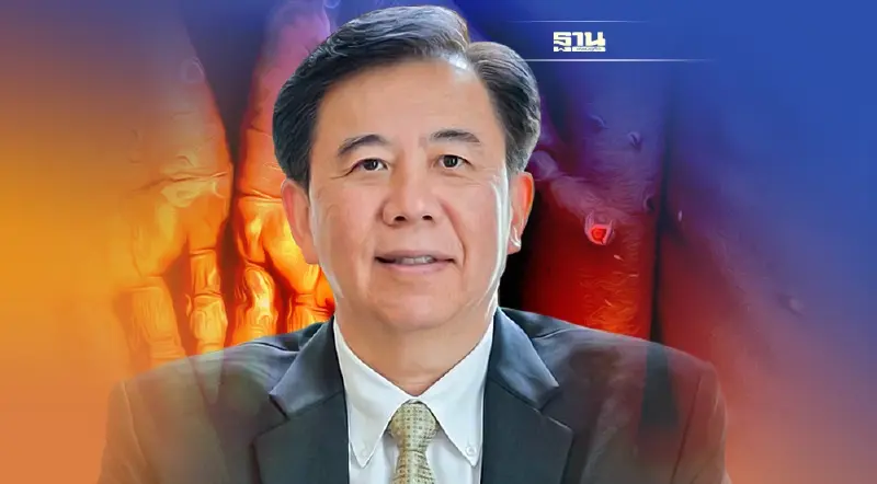 ไขประเด็น  'ฝีดาษลิง'  5 ประเด็นที่เบาใจ  5 ประเด็นที่น่ากังวล