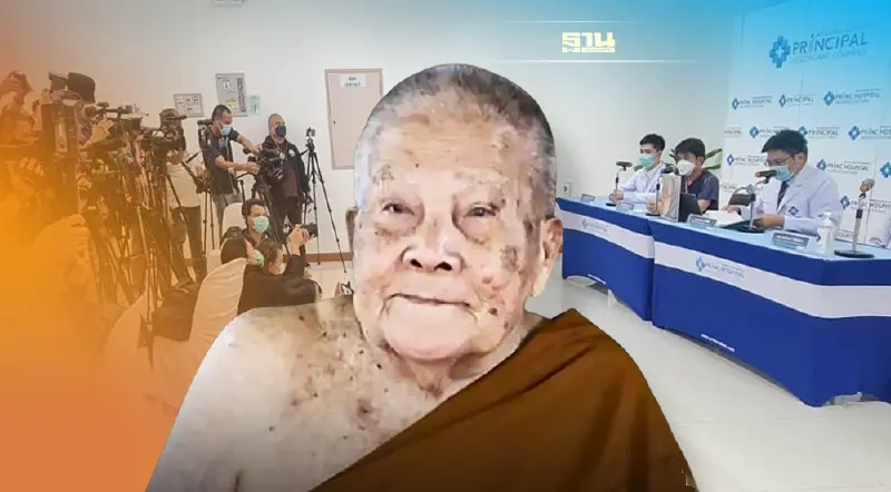 คณะแพทย์แถลง 10 อาการอาพาธ “หลวงปู่แสง ญาณวโร”