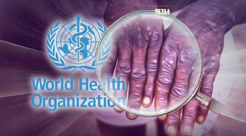 อัพเดทผู้ป่วย"ฝีดาษลิง"ลามหลายประเทศ "อนามัยโลก"เตือนไม่ปกติ