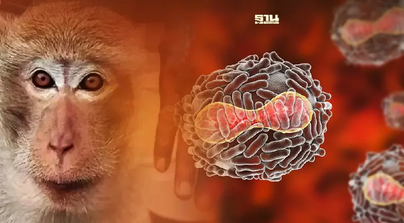 โรคฝีดาษลิง VS โรคฝีดาษ สาเหตุ – อาการ แตกต่างกันอย่างไร