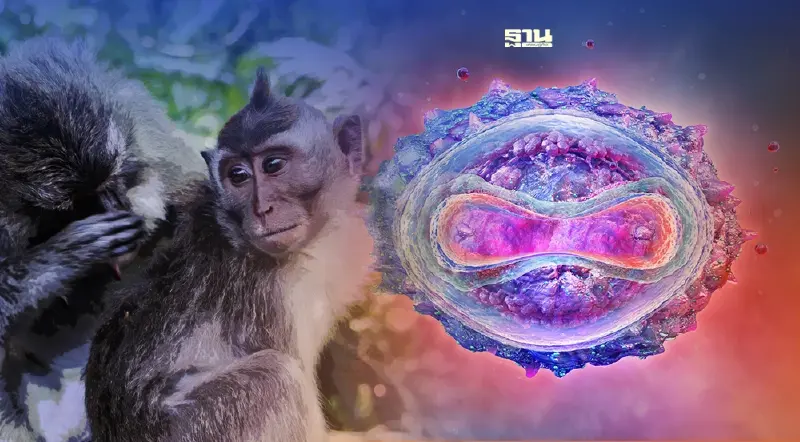 ยกระดับ "ฝีดาษลิง" เป็นโรคติดต่อเฝ้าระวังลำดับที่ 56