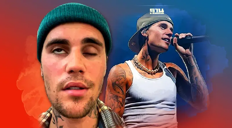 จัสติน บีเบอร์ ป่วยอัมพาตครึ่งหน้า โรคใกล้ตัวที่ไม่ควรมองข้าม  