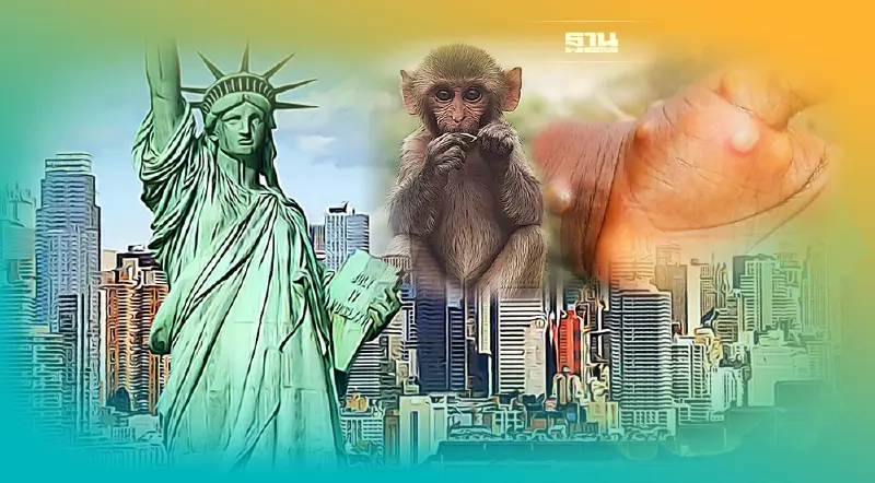 สหรัฐฯยกระดับเตือนภัยโรคฝีดาษลิง ถอดคำแนะสวมหน้ากากอนามัยป้องกัน