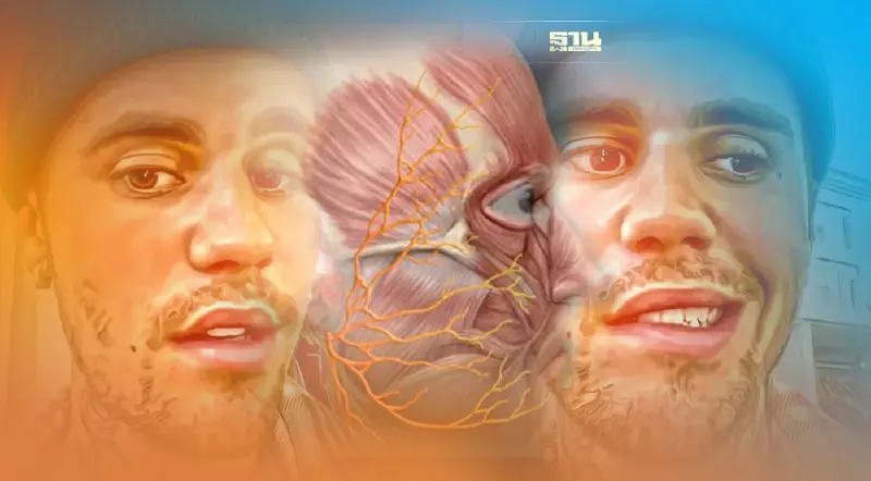 'จัสติน บีเบอร์ ' ป่วยอัมพาตครึ่งหน้า ที่มาของโรค 'รัมเซย์ ฮันต์ ซินโดรม'