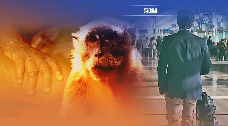 "โรคฝีดาษลิง" ผู้เดินทางไปต่างประเทศ เช็คคำแนะนำป้องกันโรคฝีดาษวานร