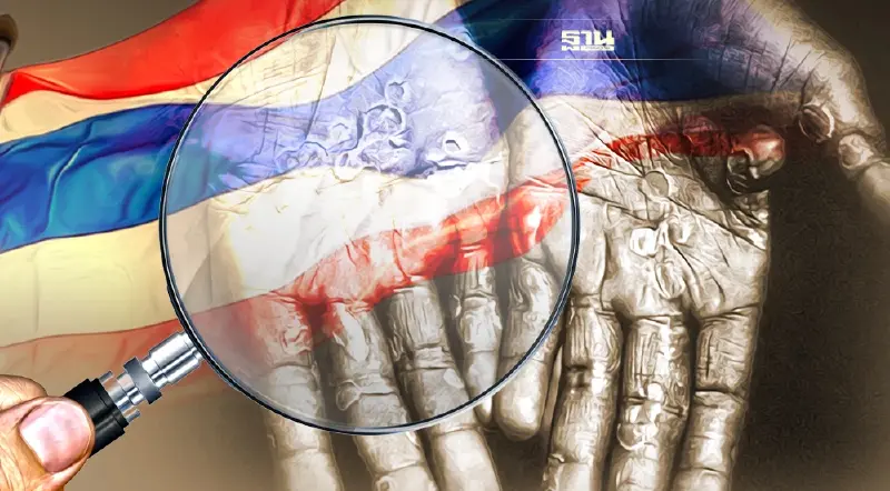 ฝีดาษ ลิงจะแพร่ระบาดในไทยหรือไม่ รุนแรงแค่ไหน อาการที่พบอยู่ที่ใด เช็คเลย