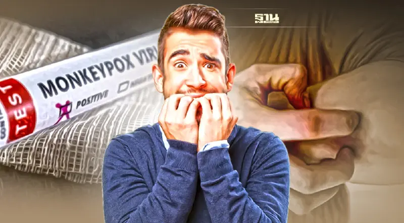 เช็คความต่าง“โรคฝีดาษลิง”กับโรคติดเชื้อไวรัส" ไข้ทรพิษ เริม สุกใส งูสวัด"