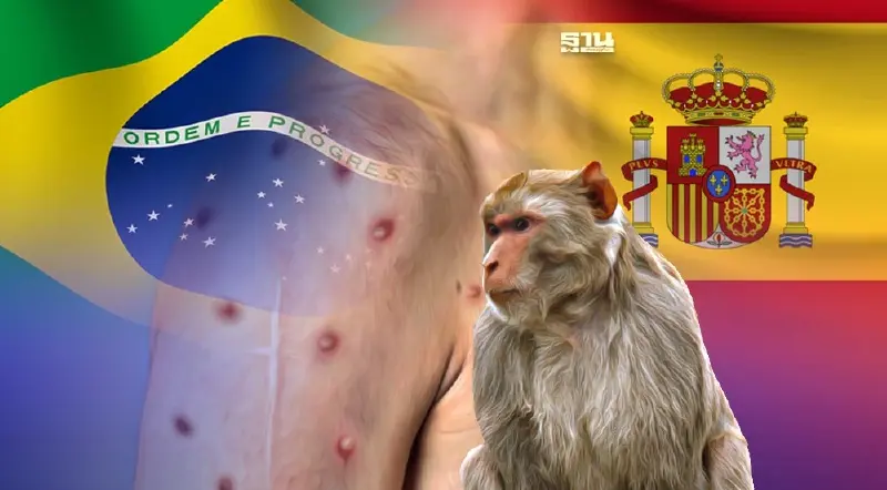 บราซิล-สเปน พบผู้เสียชีวิตจากโรคฝีดาษลิงรายแรก