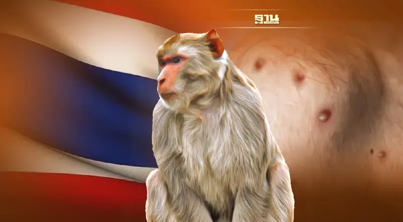 ผู้ป่วย"ฝีดาษลิง"คนแรกในไทย พบพิกัดหนีไปโผล่สระแก้ว คาดอาจเผ่นออกชายแดน