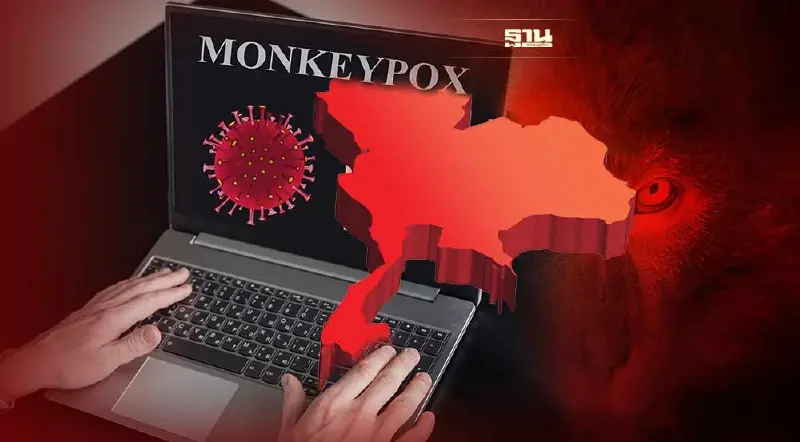 "ฝีดาษลิง"อาจมีในไทยอยู่แล้ว ก่อนพบผู้ป่วยคนแรกชาวไนจีเรียที่ภูเก็ต