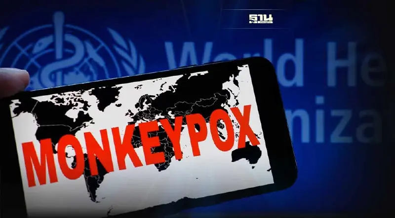 WHO ยังไม่ได้ข้อสรุปให้ "โรคฝีดาษลิง" เป็นสถานการณ์ฉุกเฉินโลก