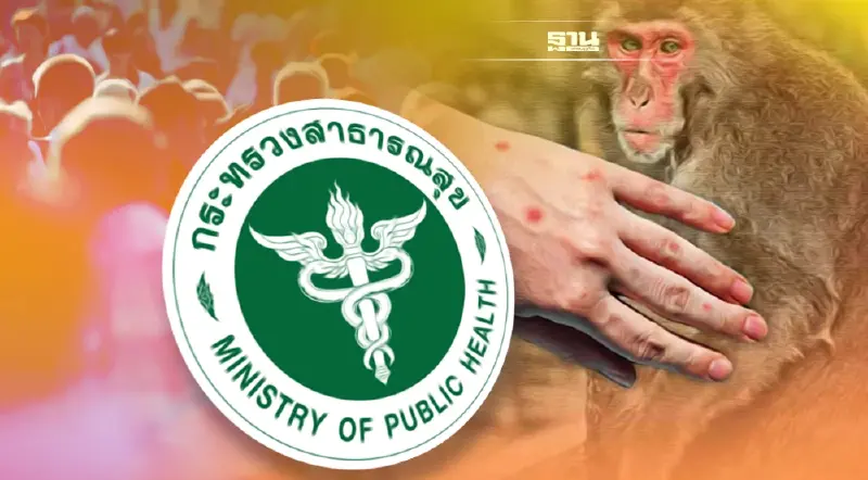 เปิดข้อมูล "ฝีดาษลิงในไทย" กรมควบคุมโรคพบ 13 ราย มีความเสี่ยงสูง