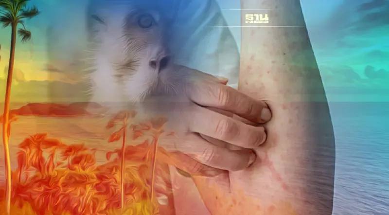 ภูเก็ต เร่งสอบสวน142 คน เข้าข่ายเกี่ยวข้องผู้ป่วยฝีดาษลิงรายแรกในไทย