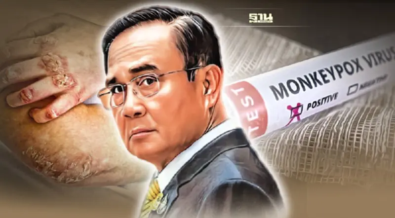 นายกฯ สั่ง สธ.เกาะติดกลุ่มเสี่ยง หลังพบผู้ป่วย "ฝีดาษลิง"รายที่ 2 นายกฯ สั่ง สธ.เกาะติดกลุ่มเสี่ยง หลังพบผู้ป่วย "ฝีดาษลิง"รายที่ 2