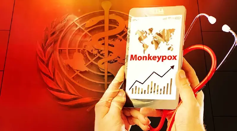 ด่วน! WHO ประกาศ โรคฝีดาษลิง เป็นภาวะฉุกเฉินด้านสาธารณสุขระหว่างประเทศแล้ว