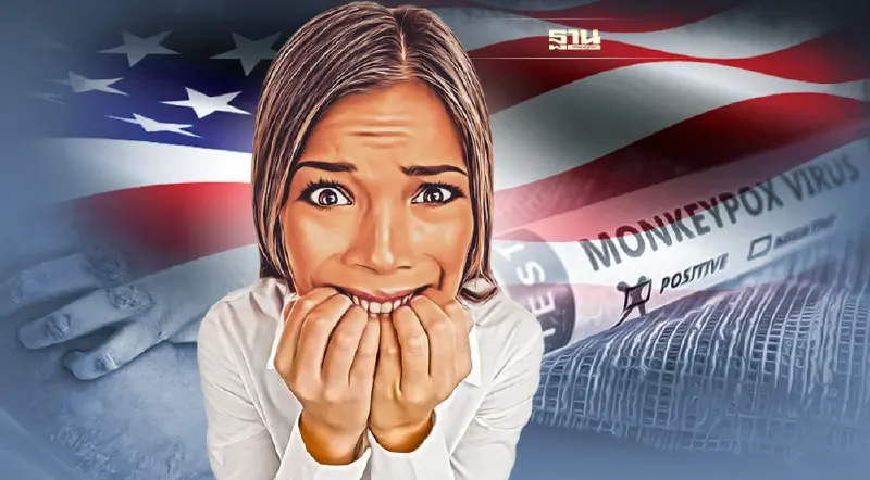 โรคฝีดาษลิง สหรัฐ ติดเชื้อสะสมมากสุดในโลกกว่า 8.9 พันคน แคนาดา ทะลุ 1 พันราย 