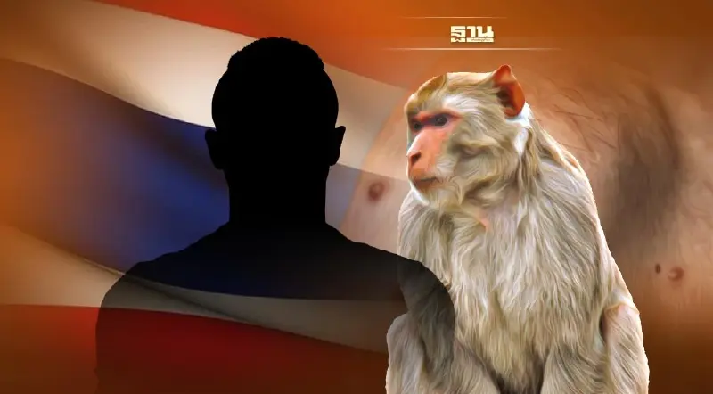 เปิดไทม์ไลน์ผู้ป่วย "ฝีดาษลิง" รายที่ 3 ในไทย พบมีกลุ่มเสี่ยง 7 ราย