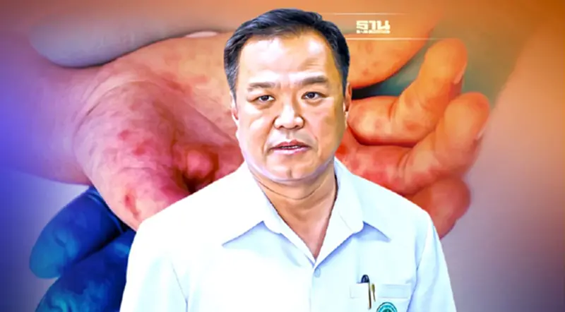 ‘อนุทิน’สั่งติดตาม‘ไข้หวัดมะเขือเทศ’ หลังเด็กในอินเดียติดเชื้อพุ่ง ‘อนุทิน’สั่งติดตาม‘ไข้หวัดมะเขือเทศ’ หลังเด็กในอินเดียติดเชื้อพุ่ง