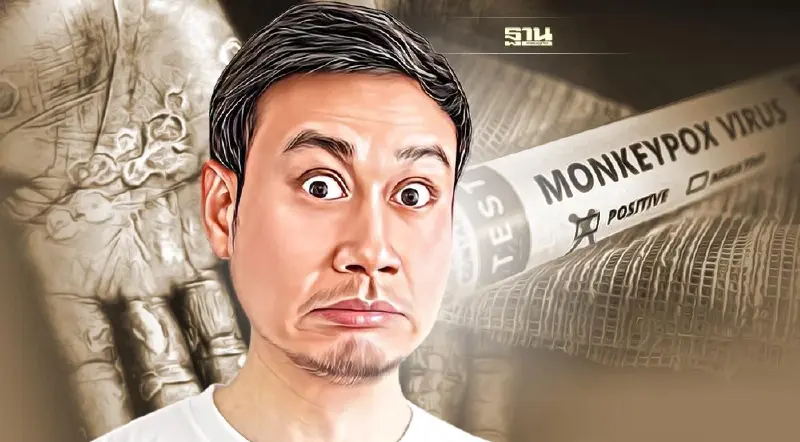 ด่วน! ไทยพบผู้ป่วย "ฝีดาษลิง" รายที่ 3 เป็นชาวเยอรมันที่ภูเก็ต