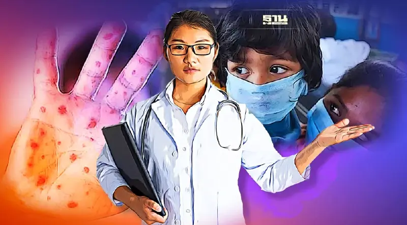 อย่าตระหนก สธ.ยันยังไม่พบ “ไข้หวัดมะเขือเทศ”ในไทย  