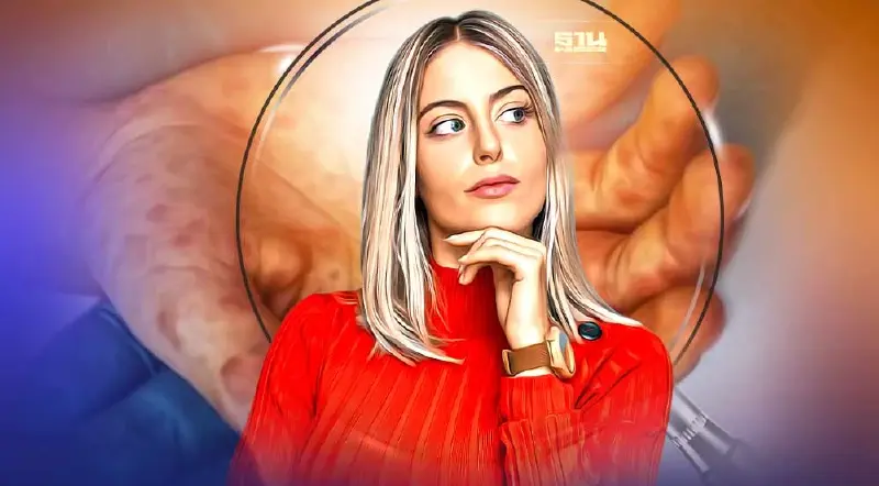 ไขคำตอบ "ไข้หวัดมะเขือเทศ" อาการเป็นอย่างไร