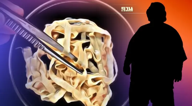 เตือน! ห้ามกินไข่พยาธิตัวตืดลดความอ้วน อันตรายแค่ไหน เช็คเลย