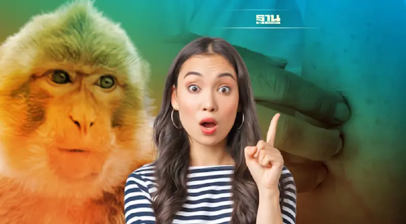 ไทยพบผู้ป่วยฝีดาษลิงรายที่ 8 เดินทางกลับจากกาตาร์