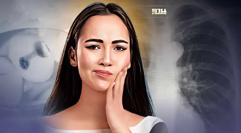 เตือน! ปล่อยฟันผุ ติดเชื้อในรากฟันเสี่ยงเกิดหนองในช่องเยื่อหุ้มปอด