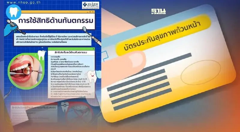 ทำฟัน"สิทธิบัตรทอง"ใช้ในกรณีใดได้บ้าง และอะไรบ้างที่ไม่ได้