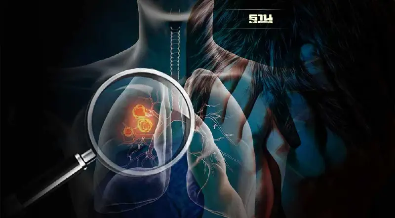 รู้จัก “มะเร็งปอด” หลังคร่าชีวิต “หม่อมน้อย” ผู้กำกับชื่อดังในวัย 69 ปี