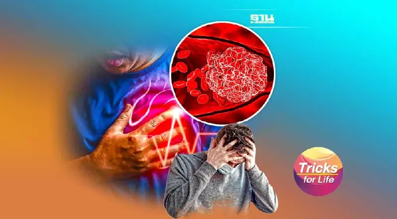 ‘ลิ่มเลือดอุดตัน’  รู้เร็ว ลดการตายเฉียบพลัน