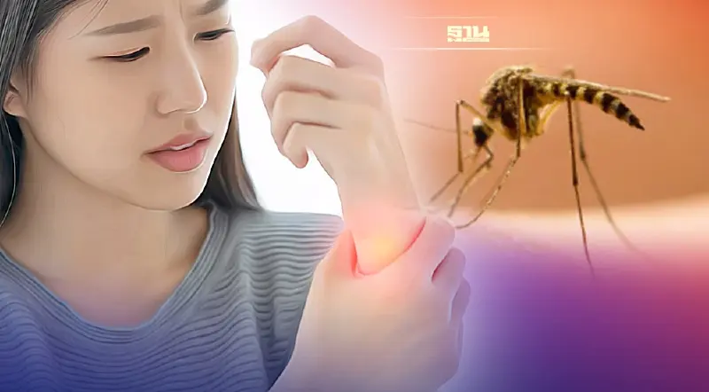 เตือน!ไข้ปวดข้อยุงลาย โรคนำโดยยุงกำลังระบาดมาก น่ากลัวแค่ไหน อ่านเลย