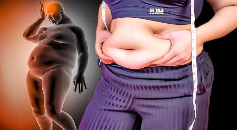 "โรคอ้วนและเบาหวาน" โรคร้ายของสังคมยุคใหม่ วัยไหนๆ ก็ควรระวัง