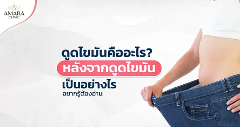 ดูดไขมันคืออะไร? หลังจากดูดไขมันเป็นอย่างไร ดูดไขมันคืออะไร? หลังจากดูดไขมันเป็นอย่างไร