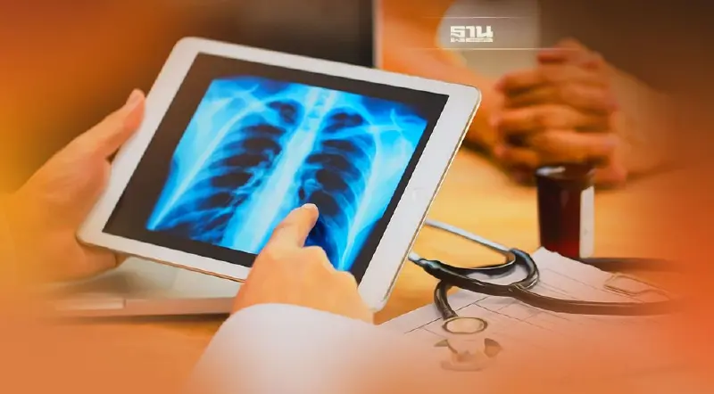 เช็ค 8 อาการมะเร็งปอด สังเกตให้ดีก่อนลุกลาม