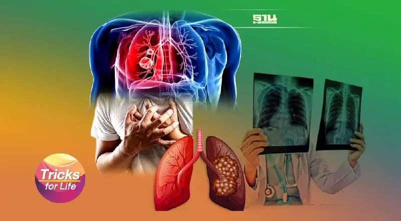 รู้หลบ ปัจจัยเสี่ยง  เลี่ยง ‘มะเร็งปอด’ ได้